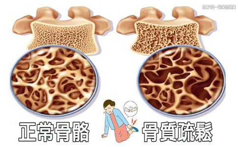 骨密度測(cè)量?jī)x廠家